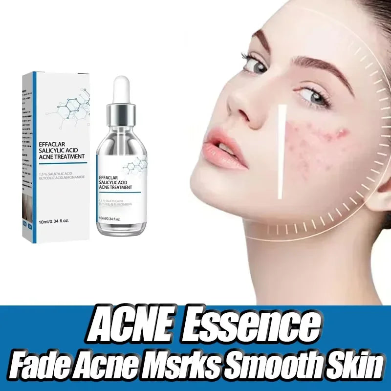 Salicylic Acid  Solution Essence Shrink pores and Acne Spot Removing Shrink Pores Oil-Control Brighten Face Skin Makeup