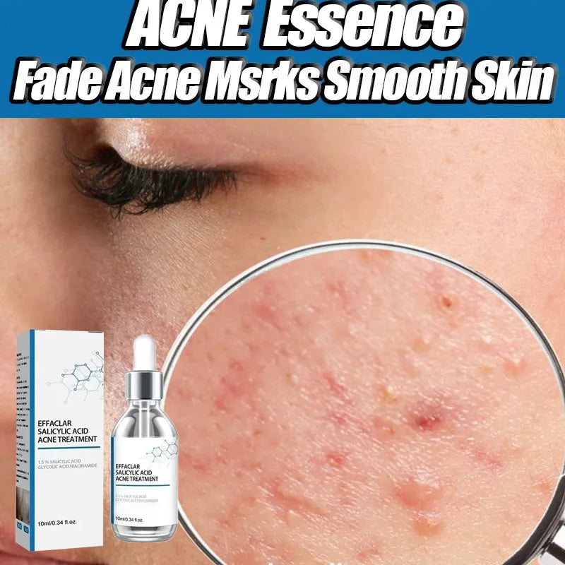 Salicylic Acid  Solution Essence Shrink pores and Acne Spot Removing Shrink Pores Oil-Control Brighten Face Skin Makeup